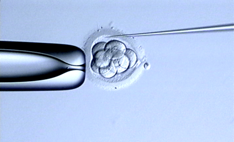 アシステッドハッチングの写真