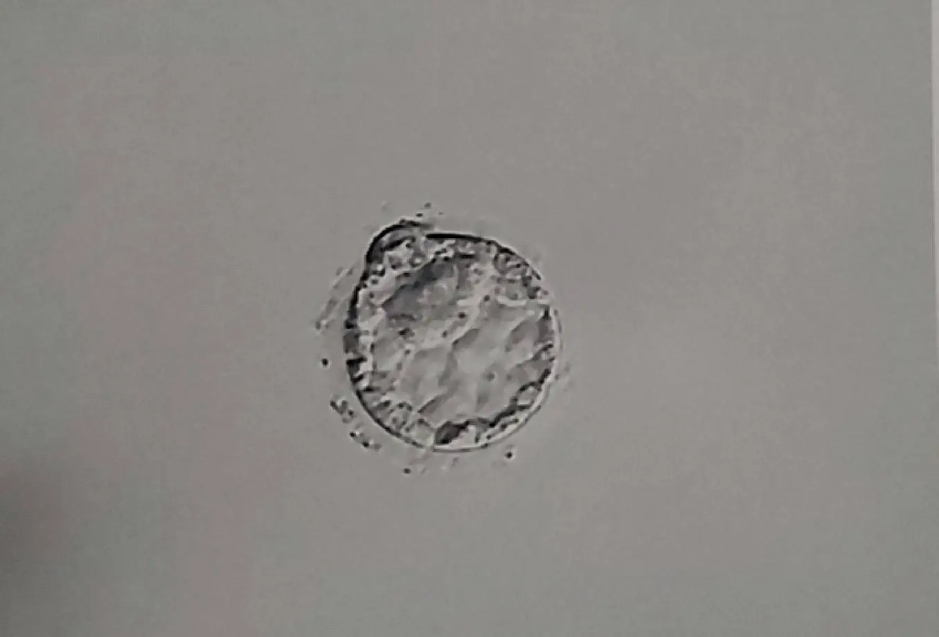 胚の居場所について